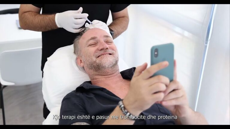 Haartransplantation: Die besten Kliniken in Gent