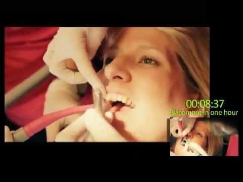Cosmetische Zahnmedizin in Gent: Experten f&uuml;r &Auml;sthetik und Gesundheit
