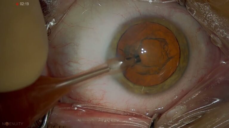 Augenkliniken in Gent: Eine &Uuml;bersicht